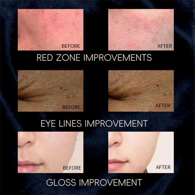 Light Therapy Face Mask Skin